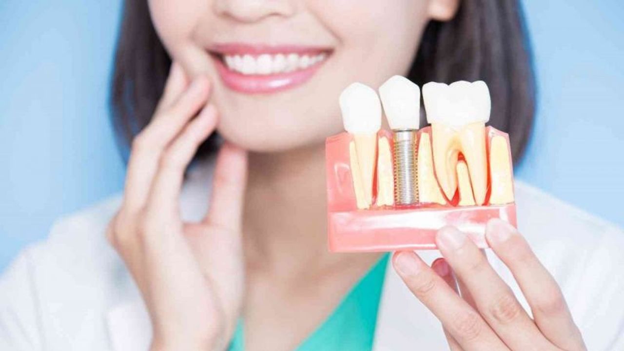 Ücretsiz Muayene yapan Nisa Dental'den 7 adımda implant hakkında merak edilenler