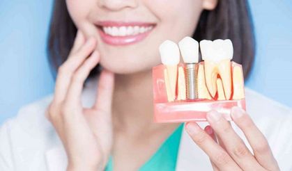 Ücretsiz Muayene yapan Nisa Dental'den 7 adımda implant hakkında merak edilenler