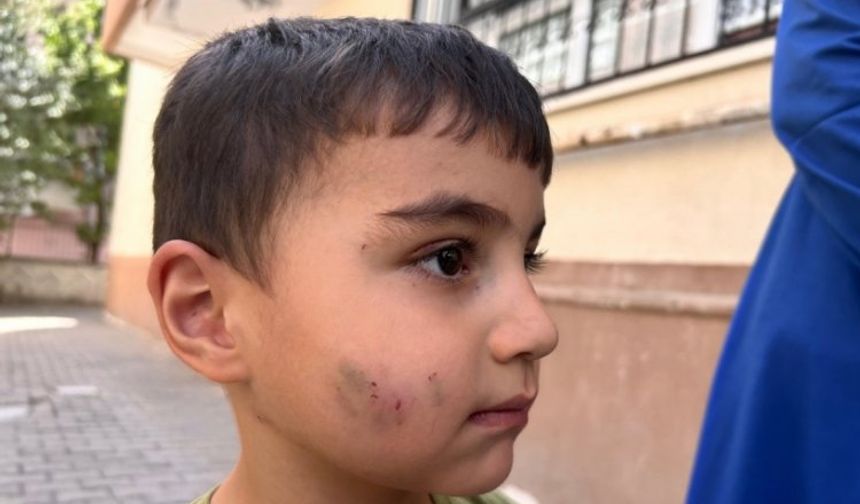 Ankara Sincan’da uyuyan çocuğulağım faresi ısırdı